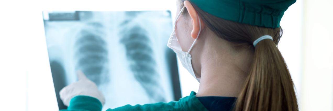 Sanitario observando una radiografía de torax