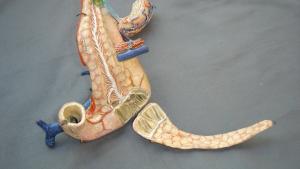 Páncreas con duodeno y yeyuno