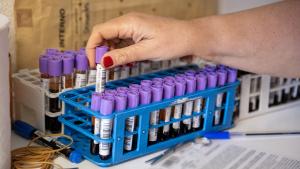 Una mano recoge un tubo de muestra de sangre