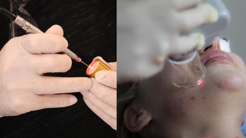 Imagen en la que se muestran diferentes usos de la Medicina Láser