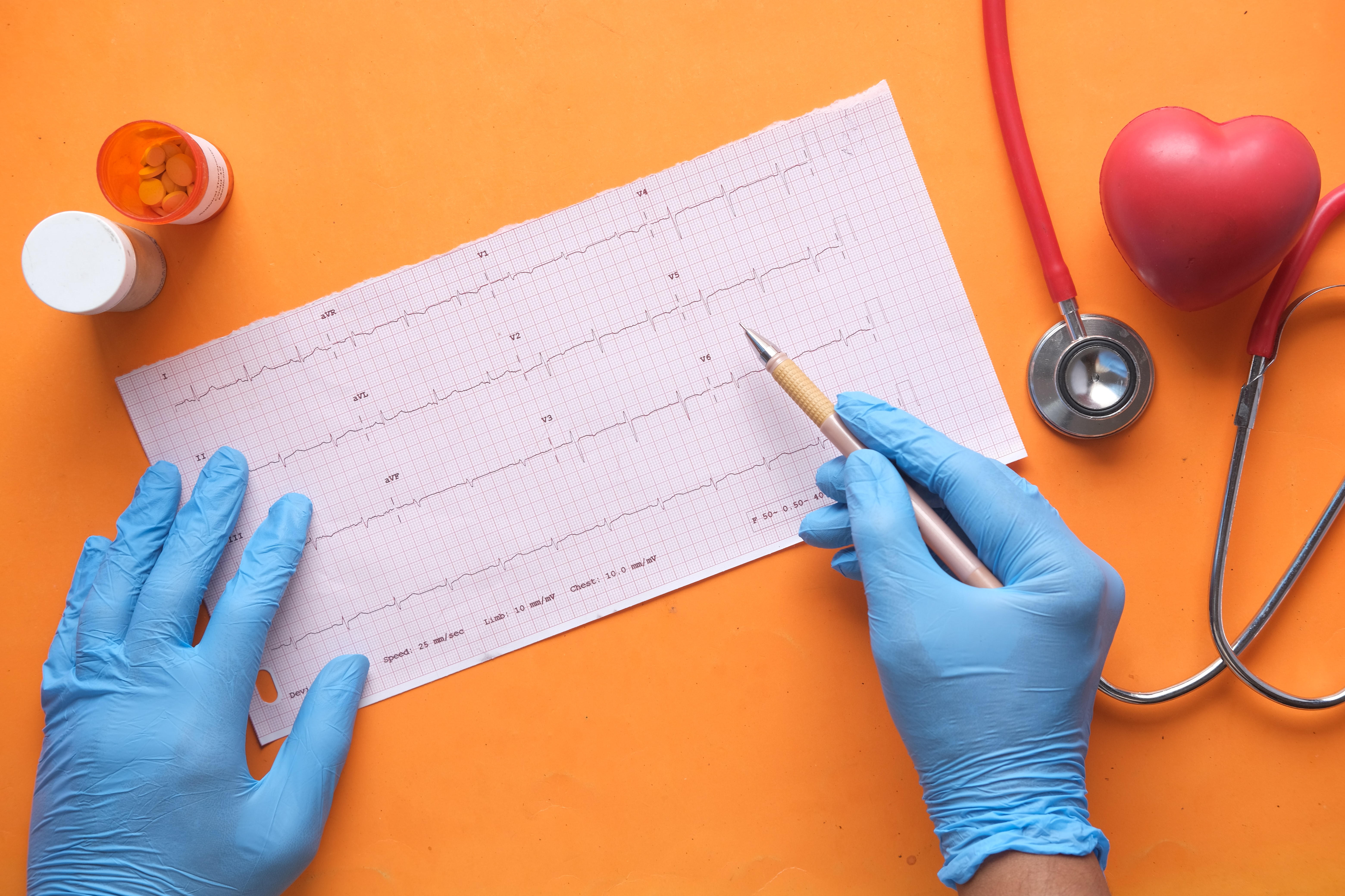 Imagen electrocardiograma