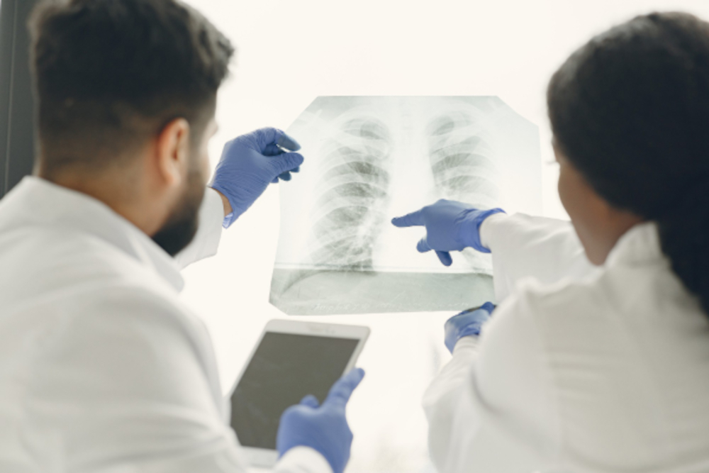 Un médico y una médico observando una radiografía de los pulmones