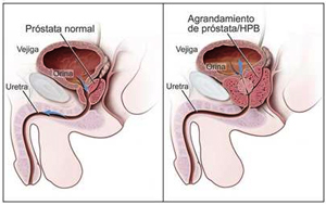 anatomía de la próstata