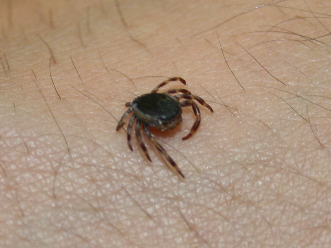 Garrapata Hyalomma Imagen de una garrapata del género Hyalomma sobre una piel humana