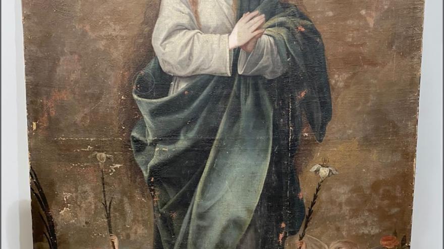  Inmaculada anterior  restauración