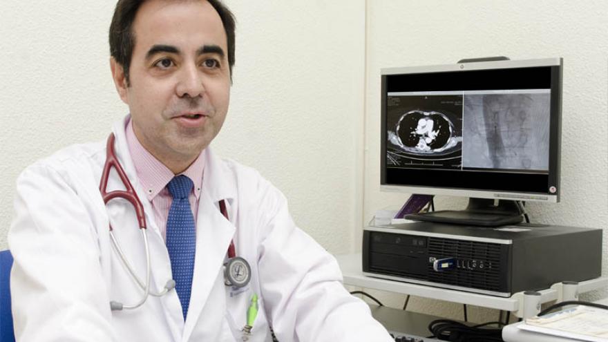 Javier de Miguel, Jefe del Servicio de Neumología del Hospital Gregorio Marañón Javier de Miguel, Jefe del Servicio de Neumología del Hospital Gregorio Marañón