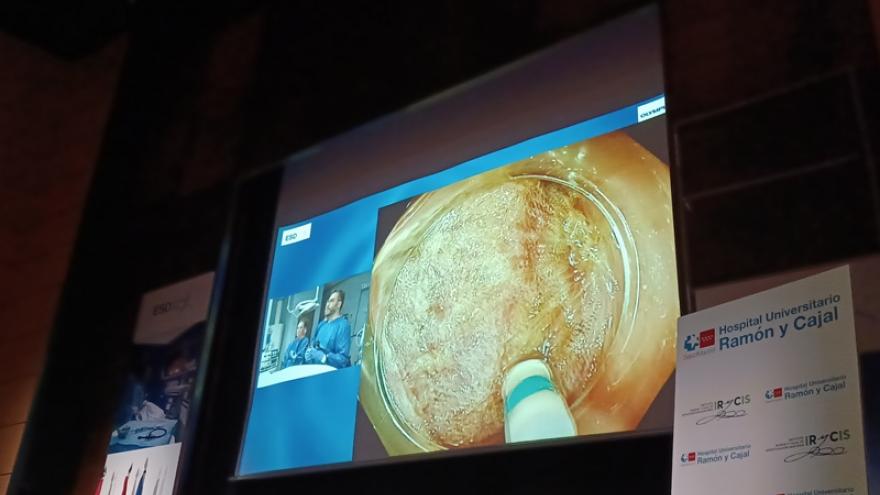 ESD Cutting Edge ha tenido diez casos en vivo
