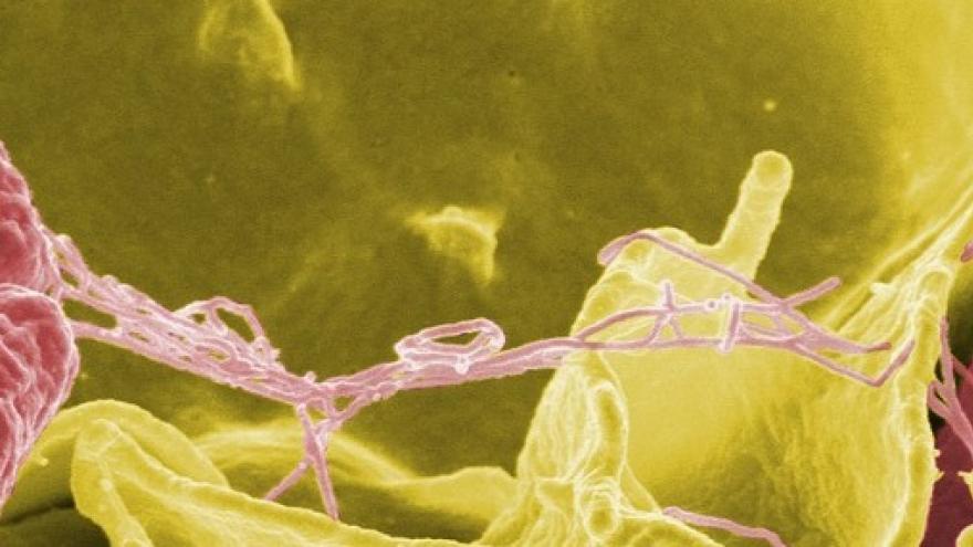 Vista microscópica de Salmonella Vista microscópica de Salmonella