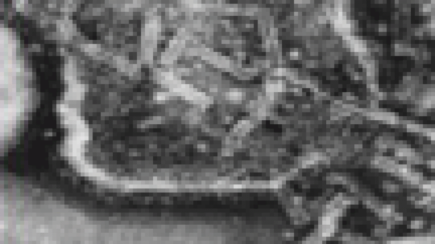 Imagen virus sarampión Imagen al microscopio del virus del sarampión