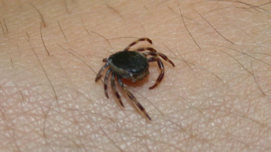 Imagen de una garrapata del género Hyalomma sobre una piel humana