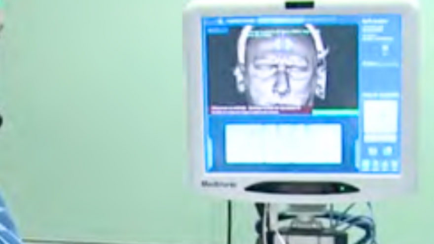 Dos profesionales médicoa mirando una pantalla con una imagen de un cabeza