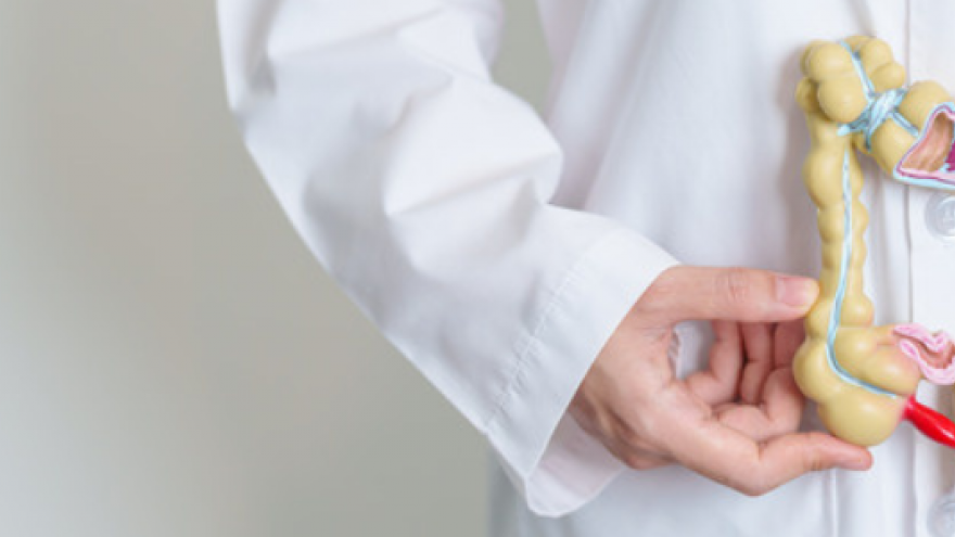 Médico sosteniendo un modelo de plástico del aparato digestivo