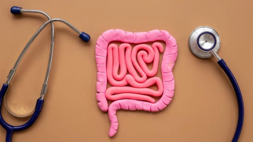 Enfermedad Inflamatoria Intestinal