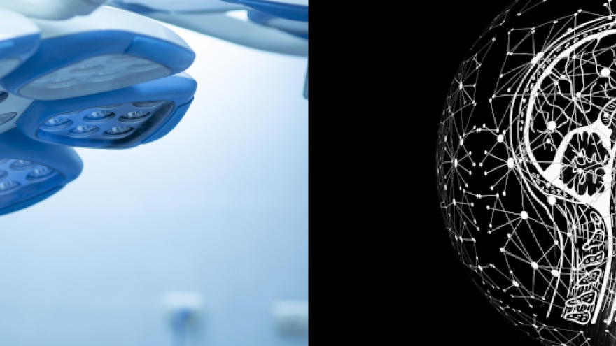 Imagen de quirófano e imagen icónica de un cerebro humano