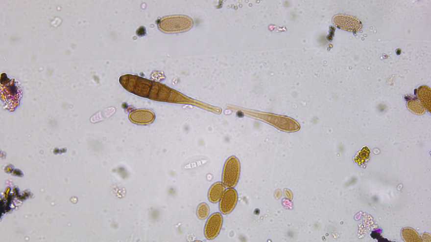 Esporas de alternaria al microscopio óptico
