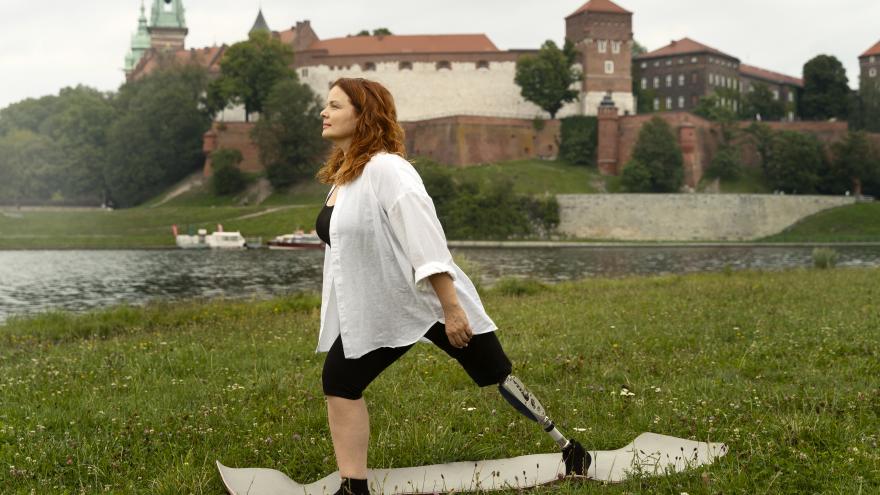 Jornada sobre paciente amputado 