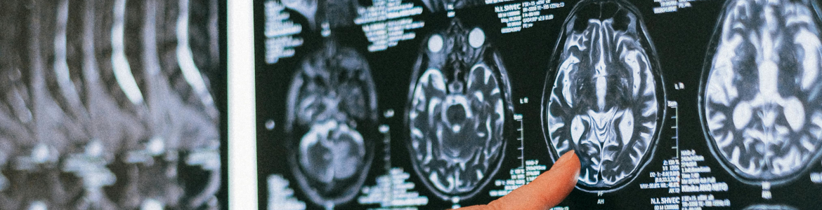 Imagen de una radiografía de cabeza