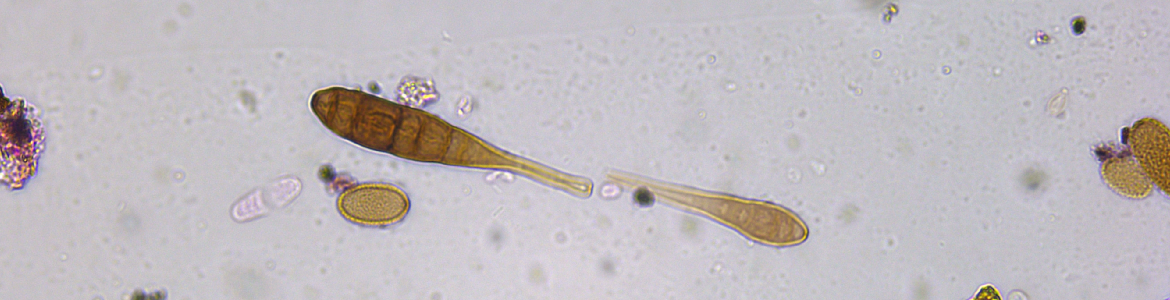 Esporas de alternaria al microscopio óptico