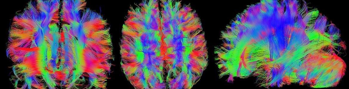 Formación Parkinson Imagen resonancia cerebro