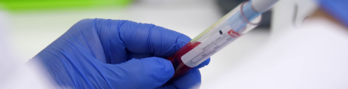 Mano con guante azul que sostiene un tubo mientras una pipeta lo llena de sangre