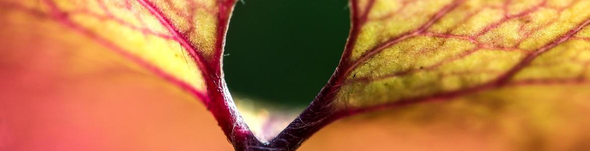 Telangiectasia hemorrágica