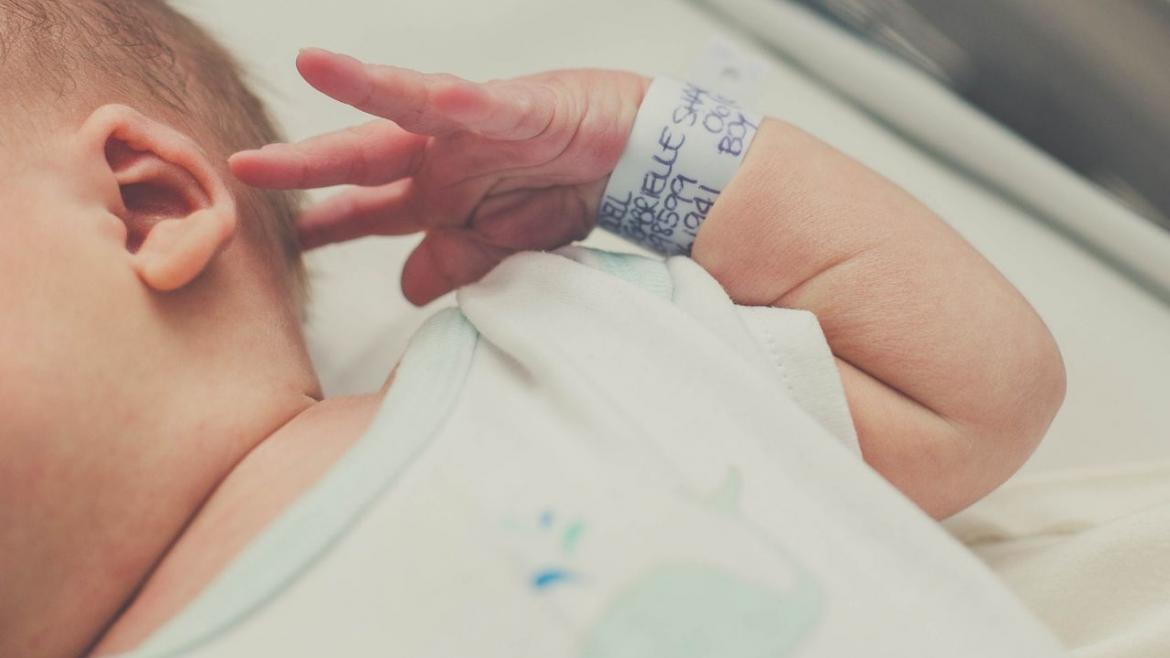 Bebé con defecto congénito de cuatro dedos en una mano