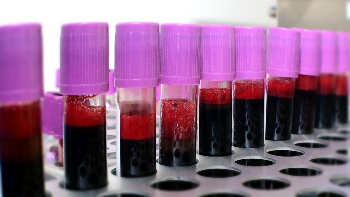 Muestras de sangre listas para ser analizadas Muestras de sangre listas para ser analizadas