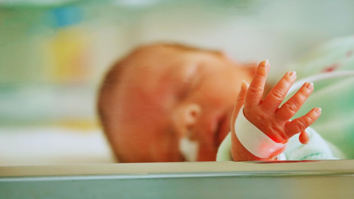 Hospital Severo Ochoa | Día Mundial de los Defectos Congénitos Bebé con defecto congénito