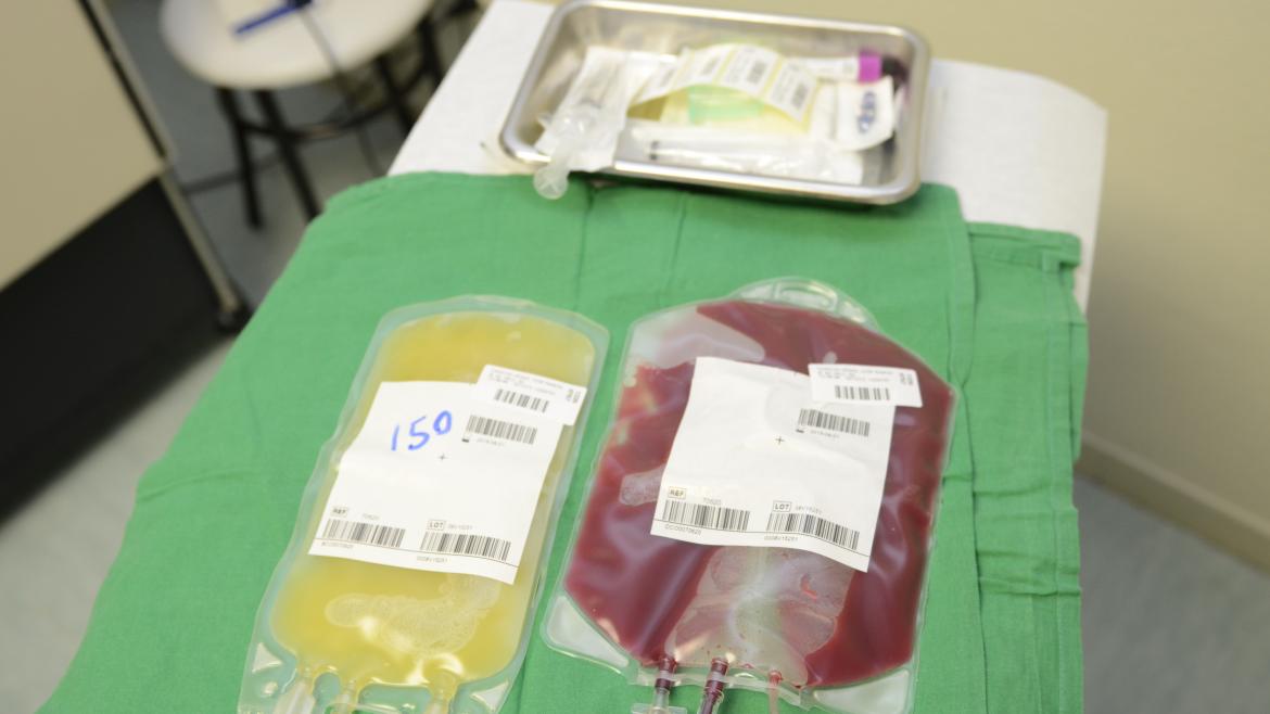 Componentes para trasplante de médula ósea