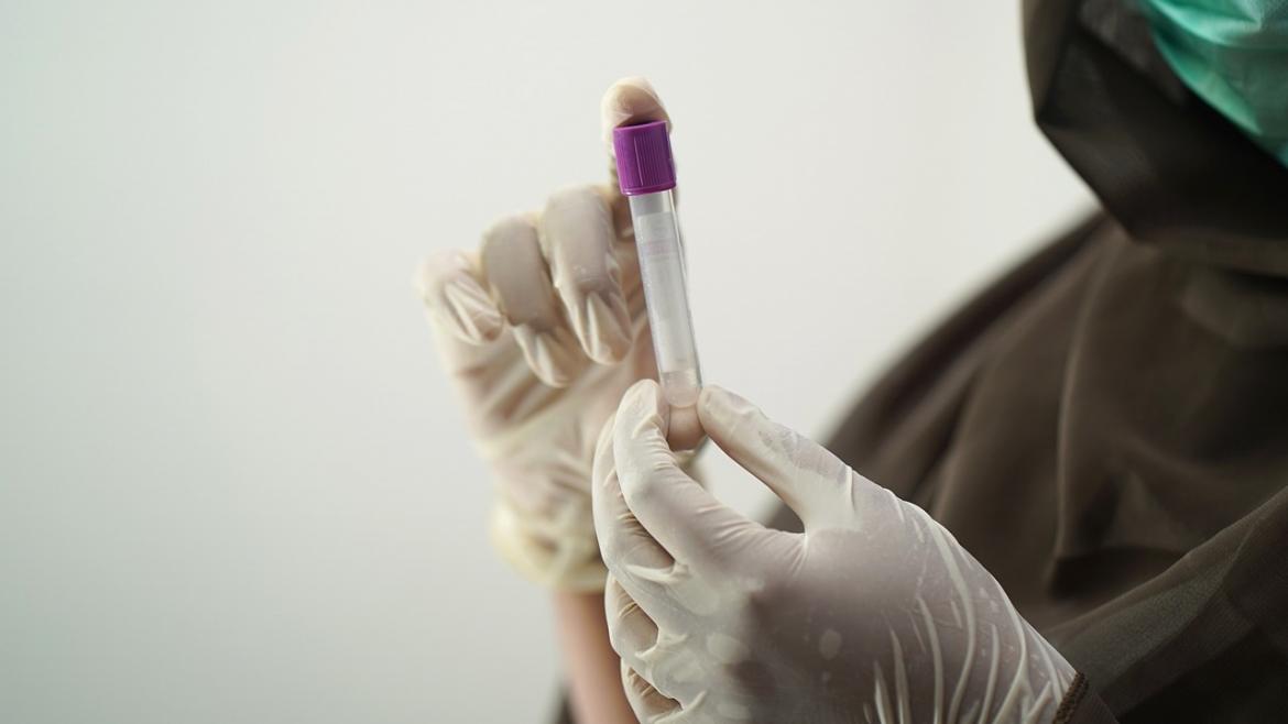 Prueba de sangre
