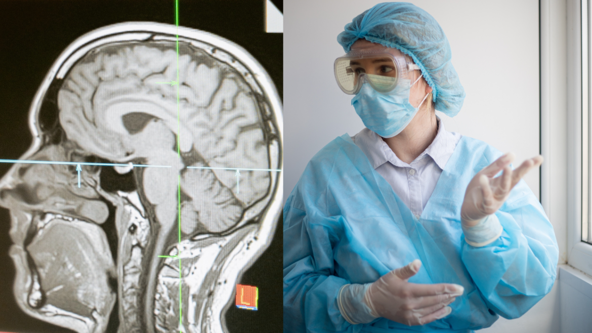 Imagen de escaner cerebral junto a una enfermera