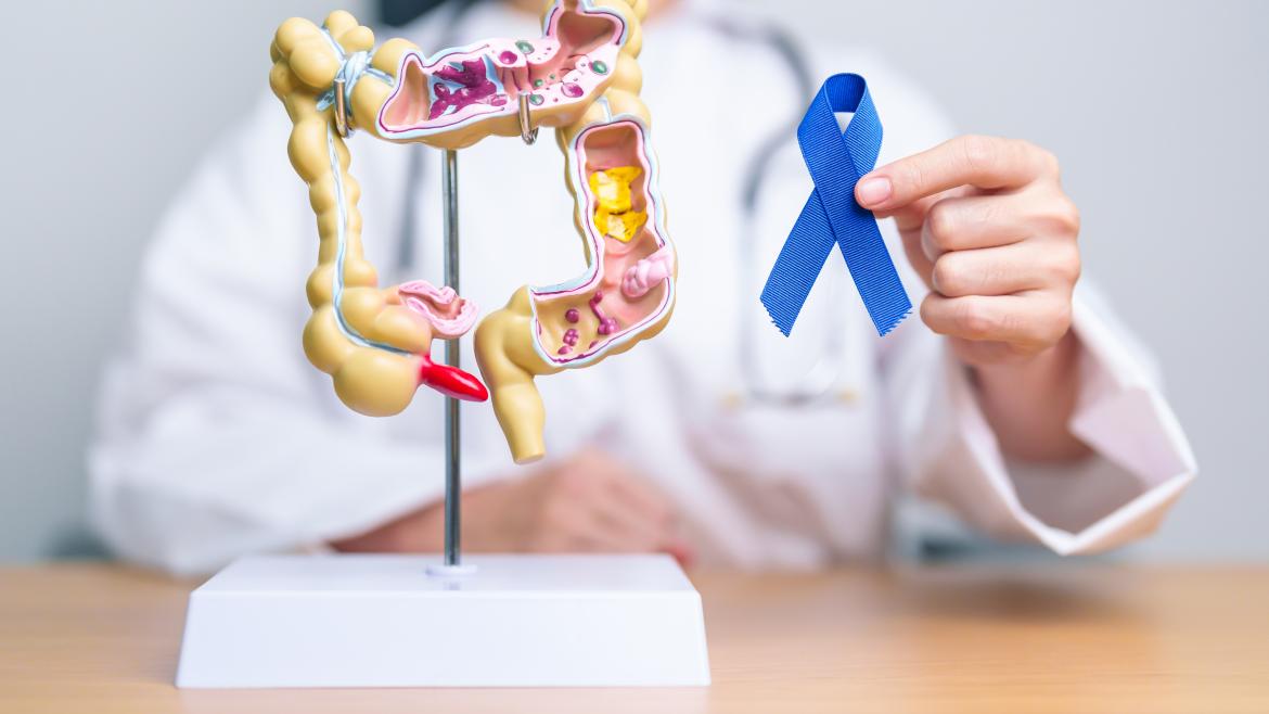 PREVECOLON Profesional sanitario en la Detección Precoz de Cáncer de Colon y Recto