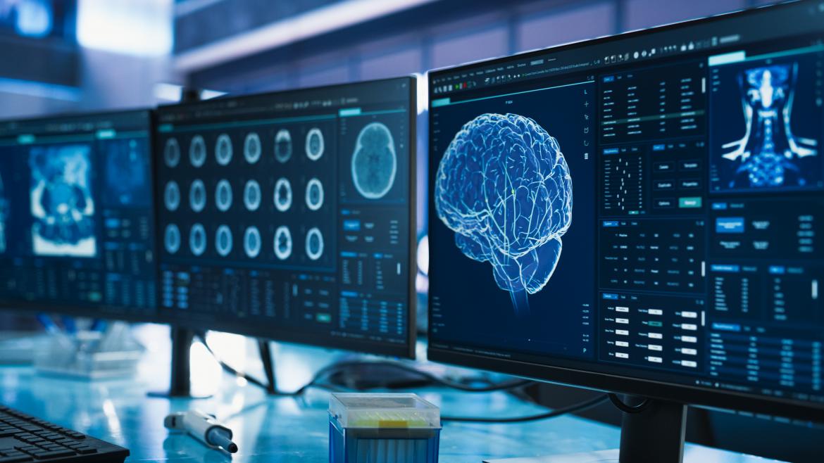 cerebro humano estudio del cerebro humano