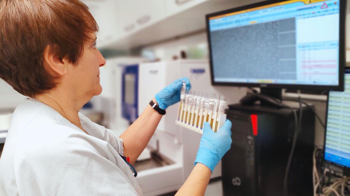 Análisis de orina en Laboratorio clínico