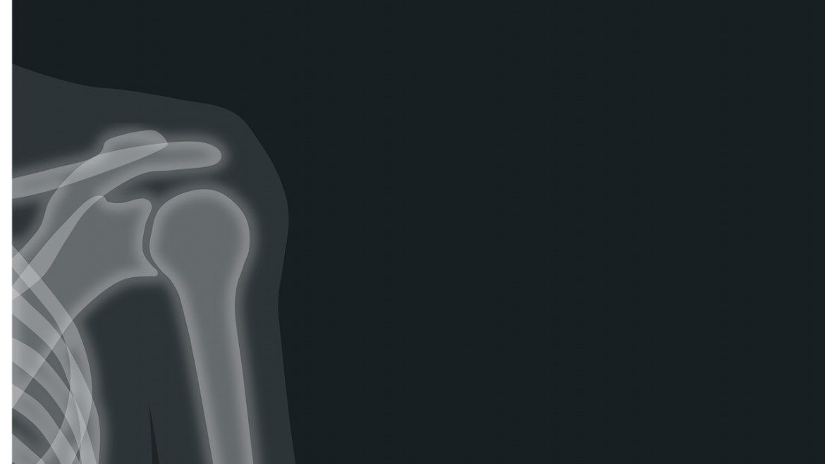 Imagen de cabecera #0 de la página de "El Santa Cristina entrena a los médicos residentes en cirugía artroscópica de hombro"