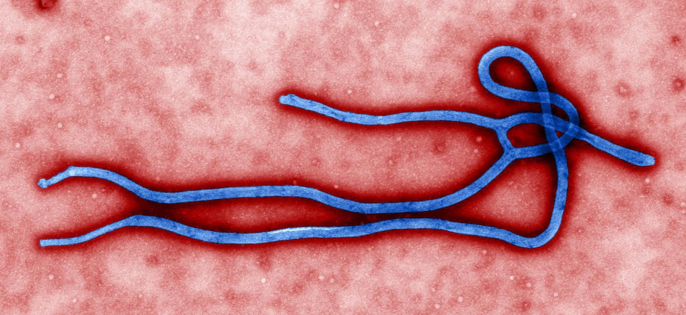 Estructura morfológica del virus ébola