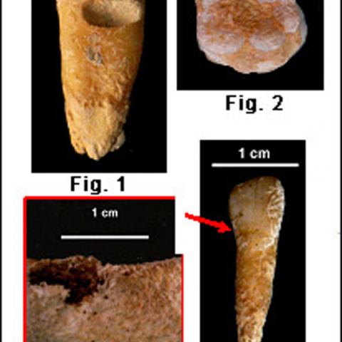 Paleopatologias orales